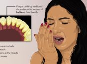 Halitosis or bad breath